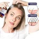 Diminui Queda 95% Aumenta Crescimento 20x | Repair Hair® - Serum Capilar (Compre 1 LEVE 2)