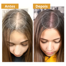 Biotim Serum Anti-Queda e Crescimento Capilar |COMPRE 1 LEVE 2| + Frete Grátis (OFERTA BLACK FRIDAY)