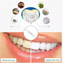 Clareador Dental - Dazzling White® |COMPRE 1 LEVE 2| + Frete Grátis (OFERTA BLACK FRIDAY)