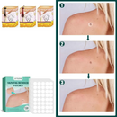 Adesivo Removedor de Verrugas Sticker Rugas |COMPRE 60 LEVE 120 ADESIVOS| + Frete Grátis