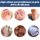 Anti Fungos Chulé Frieira Furzero™ Spray |COMPRE 1 LEVE 2| + Frete Grátis