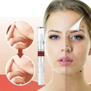 WipeOff™ Removedor de Verrugas |COMPRE 2 LEVE 3| + Frete Grátis