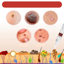 WipeOff™ Removedor de Verrugas |COMPRE 2 LEVE 3| + Frete Grátis