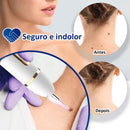 Removedor de Verrugas Laser - SkinClear Plus®