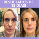 Botoxlaser Ativa o Colágeno da Pele