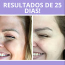 Botoxlaser Ativa o Colágeno da Pele