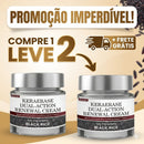 Adeus Verrugas: Creme VERRUE [COMPRE 1 LEVE 2] + Frete Grátis